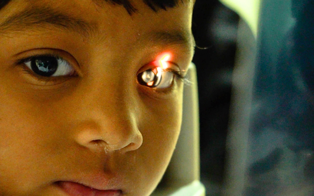 A Future in Sight Without Cataracts