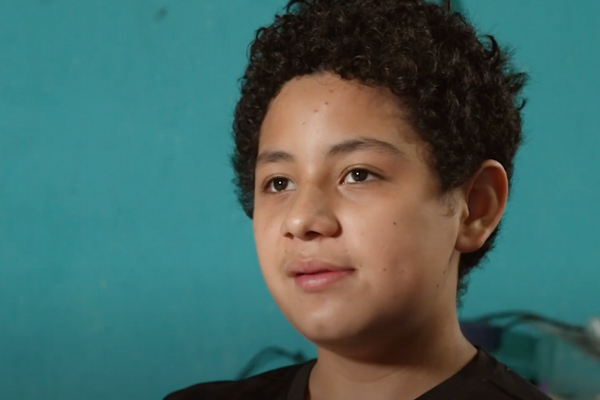 healed-from-nasal-mass-2