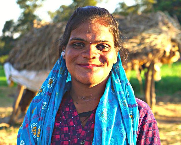 tumor-surgery-in-india