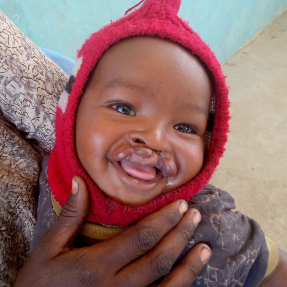 Life-Changing Surgeries - Image 3